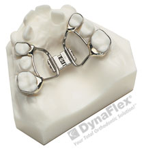 palatal expander